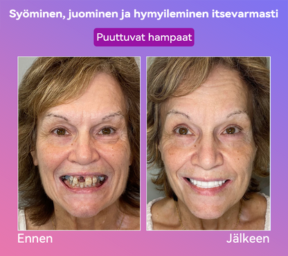 𝐉𝐚𝐬𝐬𝐞𝐞𝐦® Uusimmat Premium Comfort -Tandproteesit🎉 (Huipputason proteesit, helppo käyttää - Rajoitettu aika 70 % alennus)🔥