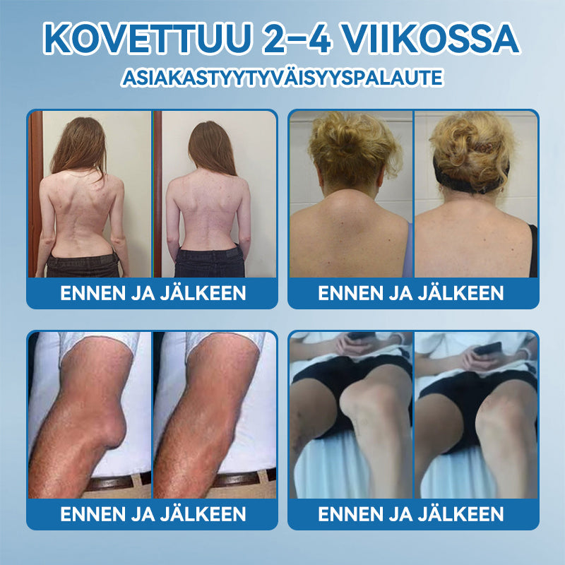 𝐕𝐢𝐫𝐚𝐥𝐥𝐢𝐧𝐞𝐧 𝐦𝐲𝐲𝐦ä𝐥ä |𝖯𝗂𝖼𝗱𝗼®🏥 𝐁𝐏𝐂-𝟏𝟓𝟕 𝐍𝐢𝐯𝐞𝐥𝐭𝐞𝐧 𝐏𝐚𝐫𝐚𝐧𝐭𝐚𝐯𝐚 𝐕𝐨𝐢𝐝𝐞🦴Hoitaa niveltulehdusta, neuropatiaa, reumaa, urheiluvammoja ja paljon muuta👍