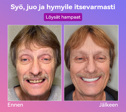 𝐉𝐚𝐬𝐬𝐞𝐞𝐦® Uusimmat Premium Comfort -Tandproteesit🎉 (Huipputason proteesit, helppo käyttää - Rajoitettu aika 70 % alennus)🔥