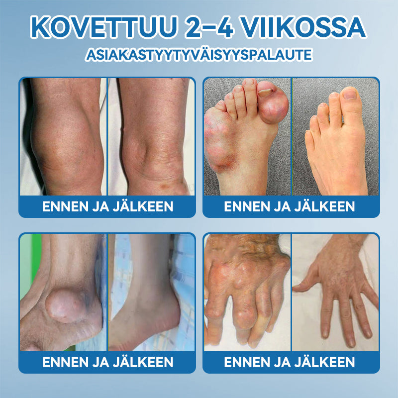 𝐕𝐢𝐫𝐚𝐥𝐥𝐢𝐧𝐞𝐧 𝐦𝐲𝐲𝐦ä𝐥ä |𝖯𝗂𝖼𝗱𝗼®🏥 𝐁𝐏𝐂-𝟏𝟓𝟕 𝐍𝐢𝐯𝐞𝐥𝐭𝐞𝐧 𝐏𝐚𝐫𝐚𝐧𝐭𝐚𝐯𝐚 𝐕𝐨𝐢𝐝𝐞🦴Hoitaa niveltulehdusta, neuropatiaa, reumaa, urheiluvammoja ja paljon muuta👍