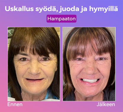𝐉𝐚𝐬𝐬𝐞𝐞𝐦® Uusimmat Premium Comfort -Tandproteesit🎉 (Huipputason proteesit, helppo käyttää - Rajoitettu aika 70 % alennus)🔥