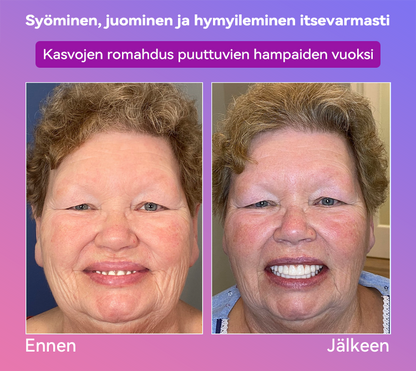 𝐉𝐚𝐬𝐬𝐞𝐞𝐦® Uusimmat Premium Comfort -Tandproteesit🎉 (Huipputason proteesit, helppo käyttää - Rajoitettu aika 70 % alennus)🔥
