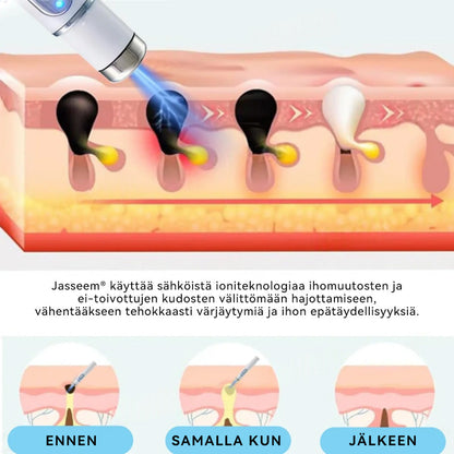 𝐉𝐚𝐬𝐬𝐞𝐞𝐦® lääkinnällisen tason laserpeni 🚚🎁 (käyttää hiilidioksidilasertekniikkaa – poistaa tehokkaasti luomet, syylät, ihotagit, pigmenttiläiskät ja muut ihon virheet)