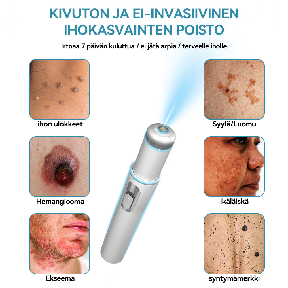 𝐉𝐚𝐬𝐬𝐞𝐞𝐦® lääkinnällisen tason laserpeni 🚚🎁 (käyttää hiilidioksidilasertekniikkaa – poistaa tehokkaasti luomet, syylät, ihotagit, pigmenttiläiskät ja muut ihon virheet)