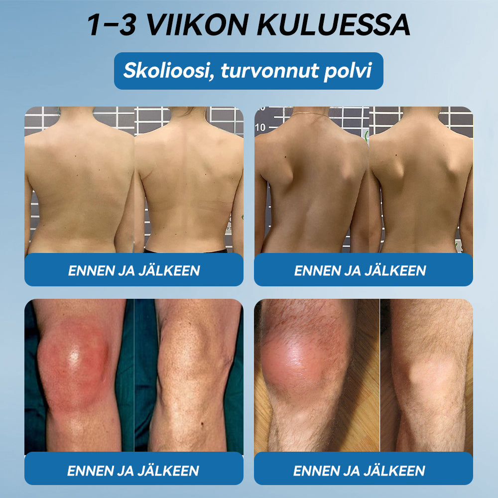 𝐕𝐢𝐫𝐚𝐥𝐥𝐢𝐧𝐞𝐧 𝐦𝐲𝐲𝐦ä𝐥ä |𝖯𝗂𝖼𝗱𝗼®🏥 𝐁𝐏𝐂-𝟏𝟓𝟕 𝐍𝐢𝐯𝐞𝐥𝐭𝐞𝐧 𝐏𝐚𝐫𝐚𝐧𝐭𝐚𝐯𝐚 𝐕𝐨𝐢𝐝𝐞🦴Hoitaa niveltulehdusta, neuropatiaa, reumaa, urheiluvammoja ja paljon muuta👍