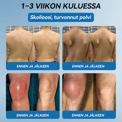 𝐕𝐢𝐫𝐚𝐥𝐥𝐢𝐧𝐞𝐧 𝐦𝐲𝐲𝐦ä𝐥ä |𝖯𝗂𝖼𝗱𝗼®🏥 𝐁𝐏𝐂-𝟏𝟓𝟕 𝐍𝐢𝐯𝐞𝐥𝐭𝐞𝐧 𝐏𝐚𝐫𝐚𝐧𝐭𝐚𝐯𝐚 𝐕𝐨𝐢𝐝𝐞🦴Hoitaa niveltulehdusta, neuropatiaa, reumaa, urheiluvammoja ja paljon muuta👍