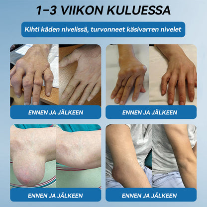 𝐕𝐢𝐫𝐚𝐥𝐥𝐢𝐧𝐞𝐧 𝐦𝐲𝐲𝐦ä𝐥ä |𝖯𝗂𝖼𝗱𝗼®🏥 𝐁𝐏𝐂-𝟏𝟓𝟕 𝐍𝐢𝐯𝐞𝐥𝐭𝐞𝐧 𝐏𝐚𝐫𝐚𝐧𝐭𝐚𝐯𝐚 𝐕𝐨𝐢𝐝𝐞🦴Hoitaa niveltulehdusta, neuropatiaa, reumaa, urheiluvammoja ja paljon muuta👍