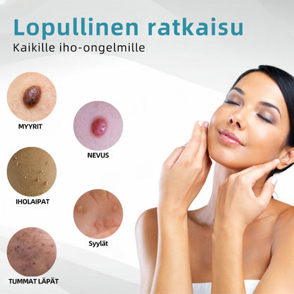 𝐉𝐚𝐬𝐬𝐞𝐞𝐦® lääkinnällisen tason laserpeni 🚚🎁 (käyttää hiilidioksidilasertekniikkaa – poistaa tehokkaasti luomet, syylät, ihotagit, pigmenttiläiskät ja muut ihon virheet)