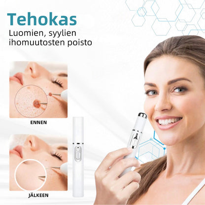 𝐉𝐚𝐬𝐬𝐞𝐞𝐦® lääkinnällisen tason laserpeni 🚚🎁 (käyttää hiilidioksidilasertekniikkaa – poistaa tehokkaasti luomet, syylät, ihotagit, pigmenttiläiskät ja muut ihon virheet)